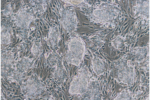Mouse ES cells on fibroblast feeder cells
