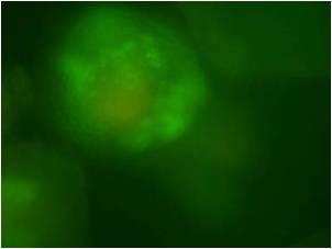 Blood vessel formation in whole EBs grown in blood vessel inhibitor Blood vessel formation in whole EBs grown in blood vessel inhibitor