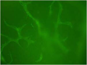 Blood vessel formation in whole EBs grown in blood vessel promoter Blood vessel formation in whole EBs grown in blood vessel promoter