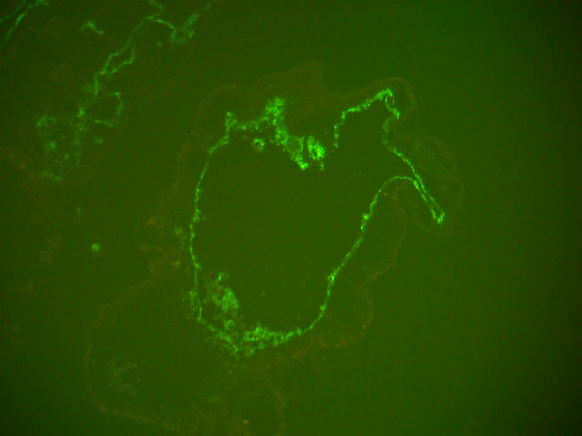 EB section stained for blood vessel formation EB section stained for blood vessel formation