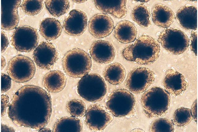 Embryoid Bodies growing in culture Embryoid Bodies growing in culture
